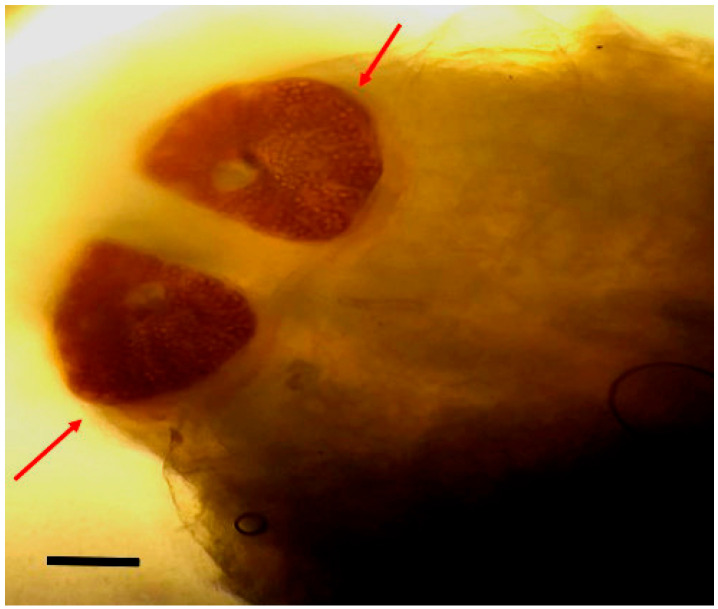 Nasal Myiasis Mimicking Allergic Rhinitis in Immunocompetent Adults: Case Series of 14 Adults.