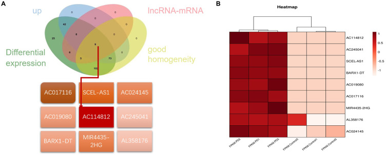 lncRNA RNA AC114812 Regulates the Inflammatory Response of Periodontal Ligament Cells via the miR-181a-5p-SPP1 Axis.