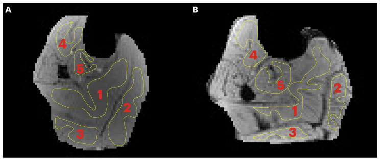 Evaluation of Magnetization Transfer Contrast Sequences: Application to Monitor Age-Related Differences in Muscle Macromolecular Fraction.