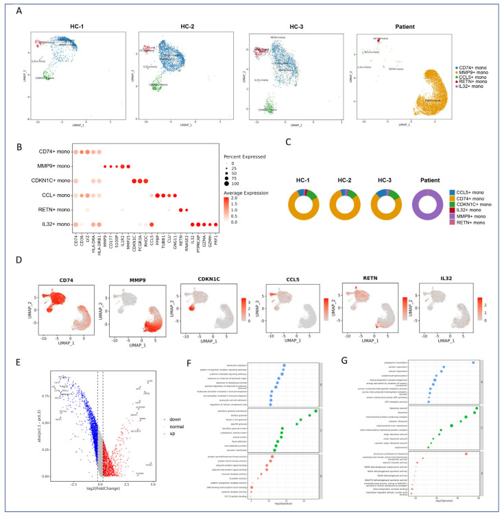 Single-Cell Transcriptomic Analysis Reveals Cell Heterogeneity and Altered Signaling Pathways in Jellyfish Sting Patients.