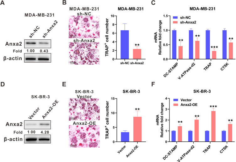 ANXA2 Regulates RANKL-Induced Osteoclast Differentiation Through STAT3 Signaling in Breast Cancer.