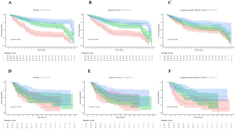 The relationship between prognostic nutritional index and its components (albumin and lymphocyte count) and all-cause mortality in lung cancer patients: a hospital-based study with database external validation.