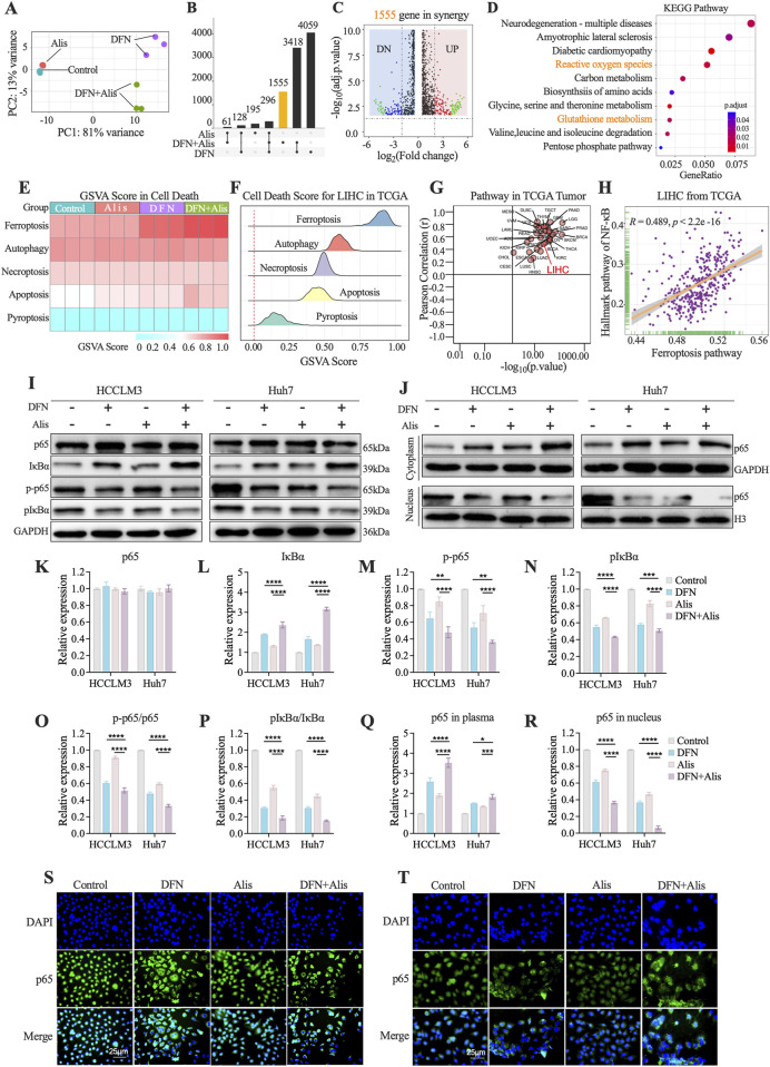 Correction: Cooperative targeting of NF-κB enhances ferroptosis-driven HCC therapy with Alisertib and Donafenib.