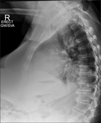 Mediastinal mass: Diagnostic dilemma on acute medical take.
