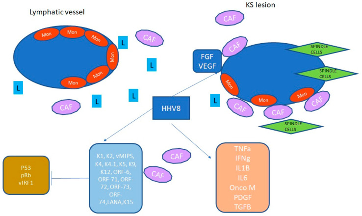 Castleman Disease and Kaposi Sarcoma: A Review of the Literature and a Case Series.