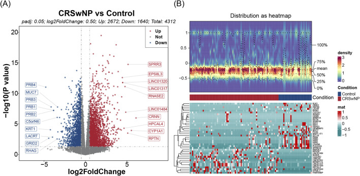 Discovering biomarkers for chronic sinusitis with nasal polyps: a study integrating bioinformatics analysis and experimental validation of macrophage polarization and metabolism-related genes.
