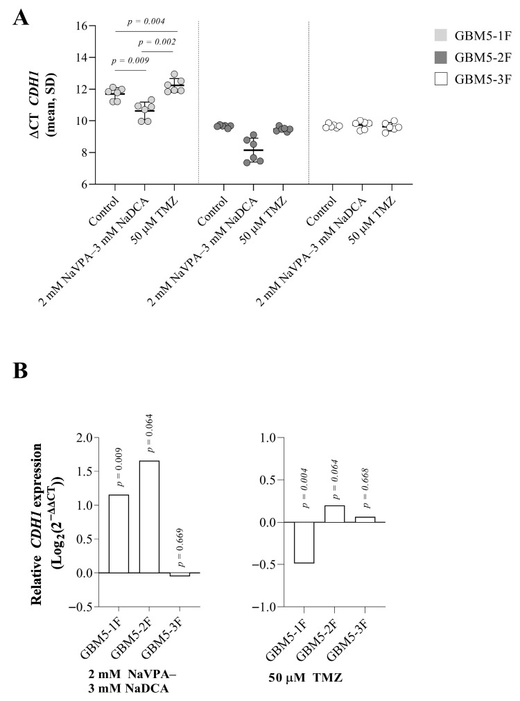 Comparison of the Effect of the Combination of Sodium Valproate and Sodium Dichloroacetate on the Expression of <i>SLC12A2</i>, <i>SLC12A5</i>, <i>CDH1</i>, <i>CDH2</i>, <i>EZH2</i>, and <i>GFAP</i> in Primary Female Glioblastoma Cells with That of Temozolomide.