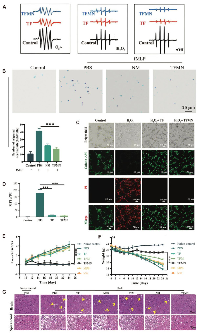 Applications of Antioxidant Nanoparticles in Immune-Mediated Inflammatory Diseases.
