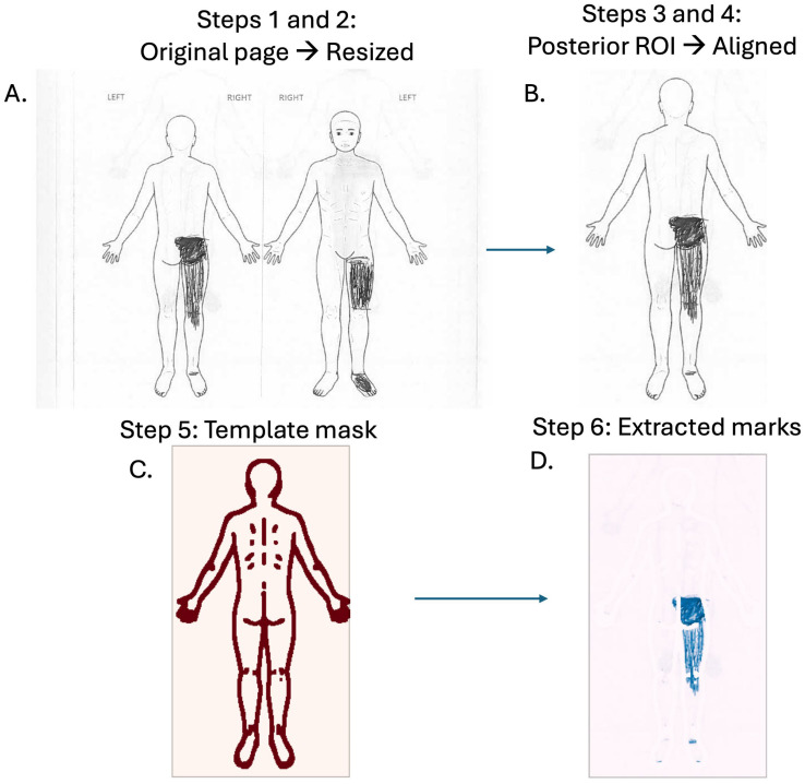A Summary of Pain Locations and Neuropathic Patterns Extracted Automatically from Patient Self-Reported Sensation Drawings.