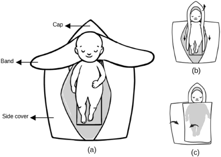 Evaluating the Impact of the Wrapping Bag <i>TECOtherm Wrabbit</i> on Temperature Stability During Therapeutic Hypothermia Treatment of Hypoxic Ischemic Encephalopathy.