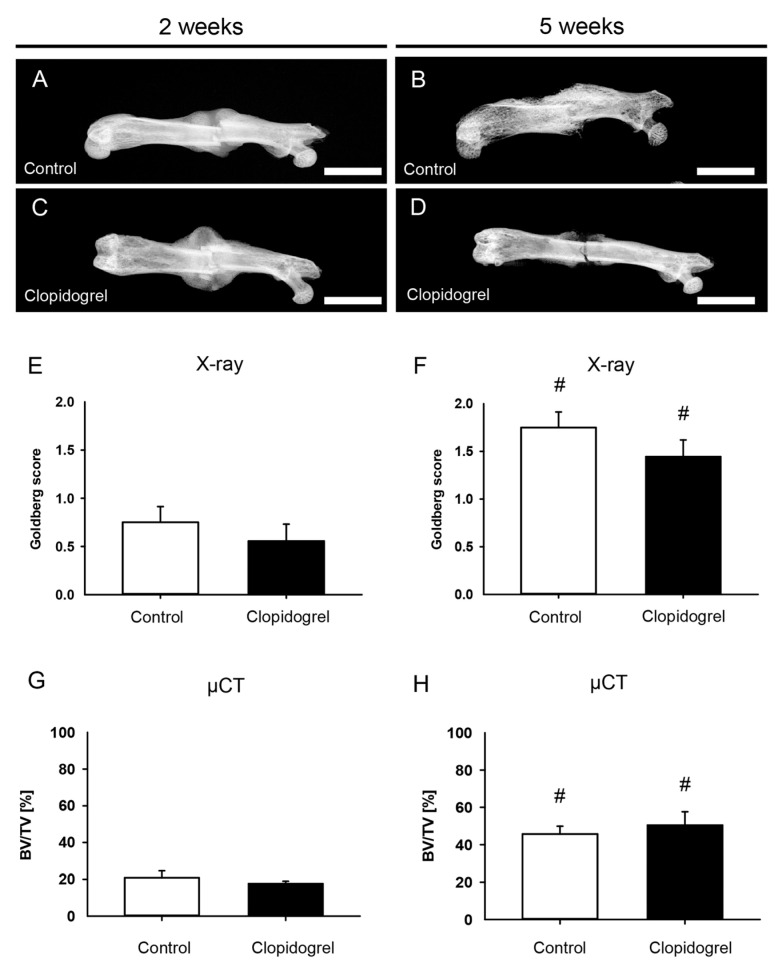 Clopidogrel Influences Fracture Healing Under Ischemic Conditions.