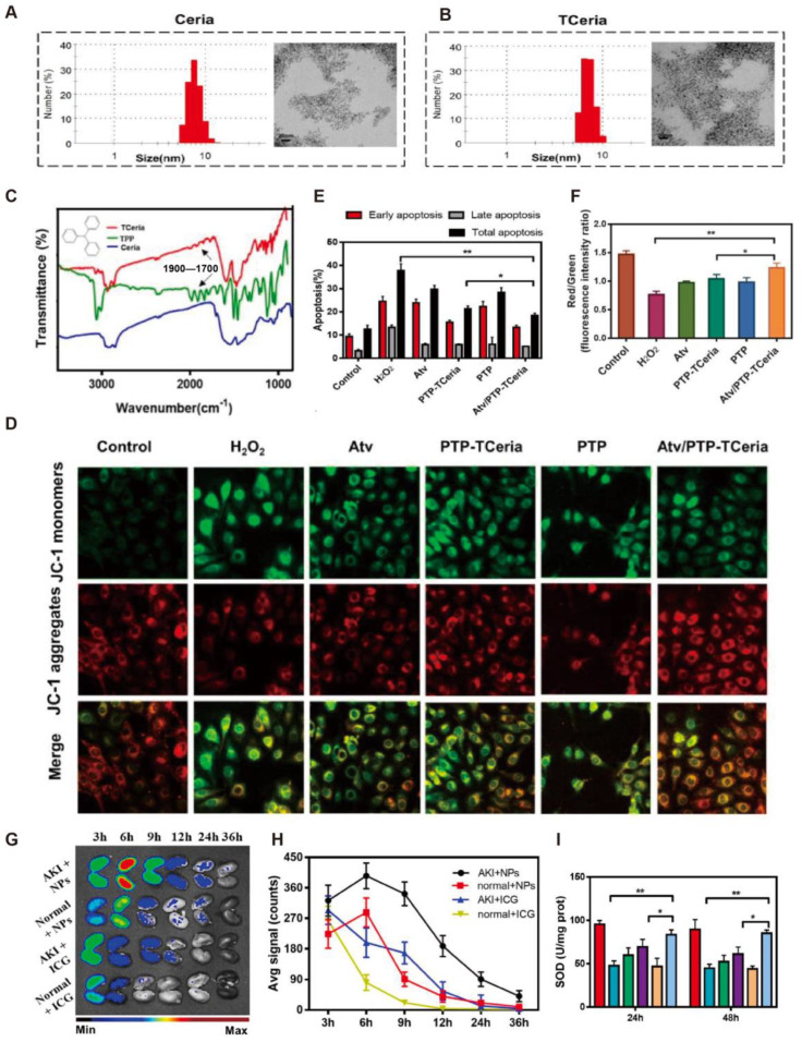 Applications of Antioxidant Nanoparticles in Immune-Mediated Inflammatory Diseases.