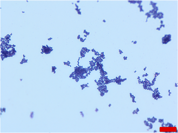 Relevance in question: A rare case of Actinomyces radicidentis bacteremia.