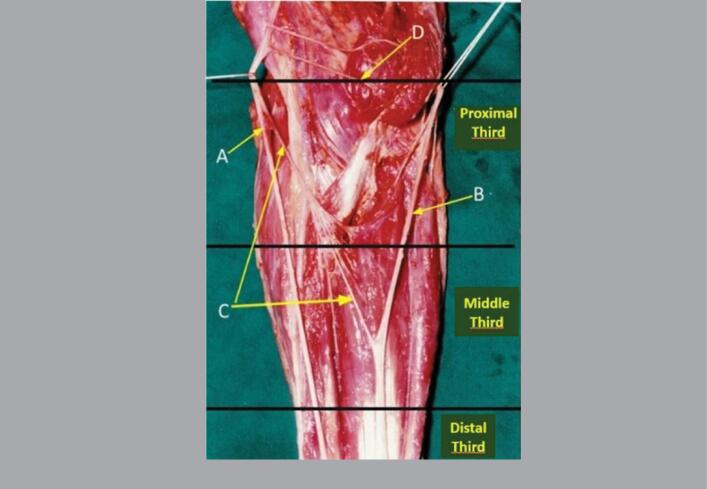 ANATOMOTOPOGRAPHIC STUDY OF THE MARTIN-GRUBER ANASTOMOSIS.
