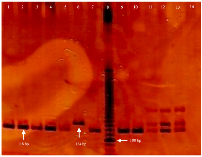 <i>TP53</i> IVS3 16 bp Variant and Breast Cancer Risk in Western Mexican Women: A Case-Control Study.