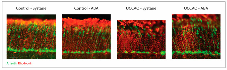 Retinoprotective Effects of Abscisic Acid in Ischemic Retinopathy Mouse Model.