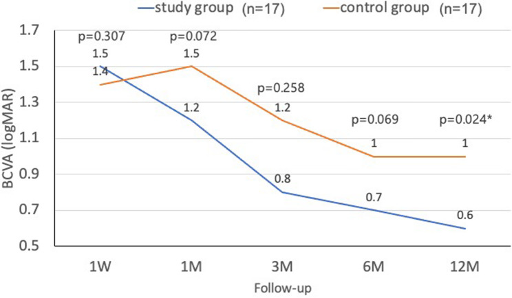 Outcome of silicone oil tamponade combined dexamethasone implantation in patients with proliferative diabetic retinopathy and retinal detachment undergoing vitrectomy: a prospective randomized controlled clinical trial.