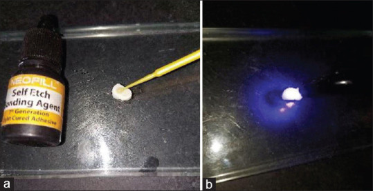 Microbrush bristle remnants on the bonding surface using different adhesive systems by scanning electron microscope: An <i>in vitro</i> study.
