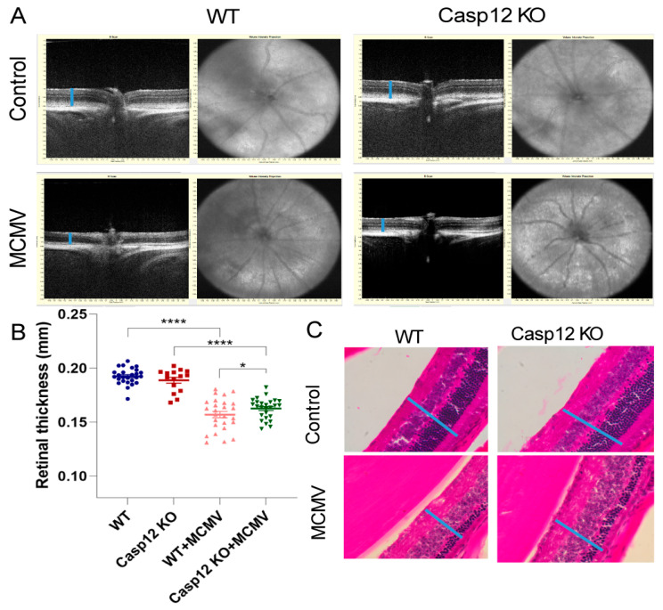Depletion of Caspase-12 Alleviates Retinal Degeneration in Aged BALB/c Mice Following Systemic Neonatal Infection by Murine Cytomegalovirus (MCMV).