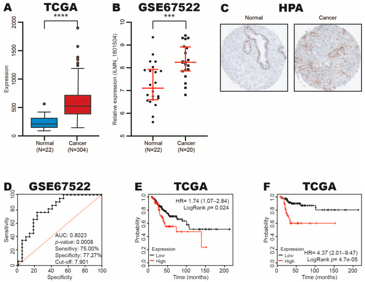 Let-7c/RUNX1 Axis Promotes Cervical Cancer: A Bioinformatic Analysis.