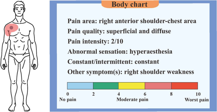 Aortic dissection disguised as musculoskeletal condition: a case report and review of literature.