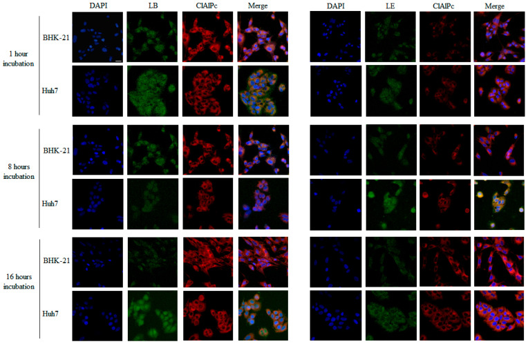 Antiviral Activity of Liposomes Containing Natural Compounds Against CHIKV.