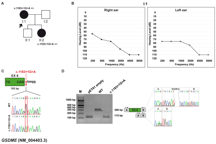 Unraveling the Functional Impact of Splicing Variants in Inherited Hearing Disorders Through Minigene Splicing Assays.