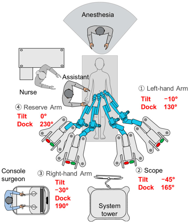 Robotic-Assisted Total Pelvic Exenteration for Rectal Cancer Using the Hugo™ RAS System: First Case Report.