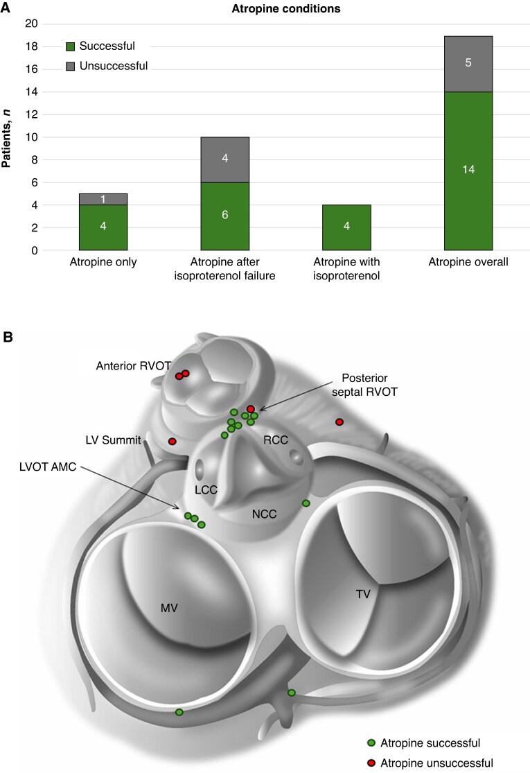 Pharmacologic parasympathetic withdrawal to facilitate activation mapping and ablation of infrequent intraprocedural premature ventricular contractions.