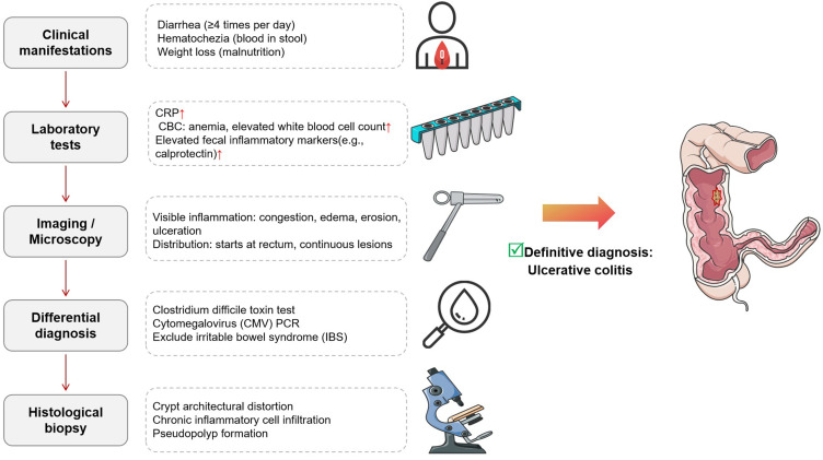 Mechanism of Morbidity Based on Ulcerative Colitis: A Review of Traditional Chinese Medicine Treatment of Ulcerative Colitis.