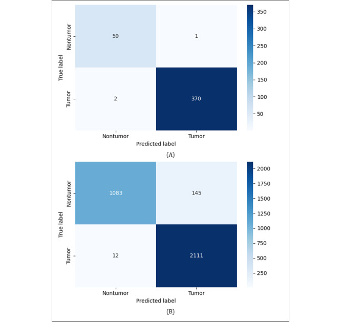Trade-Off Analysis of Classical Machine Learning and Deep Learning Models for Robust Brain Tumor Detection: Benchmark Study.