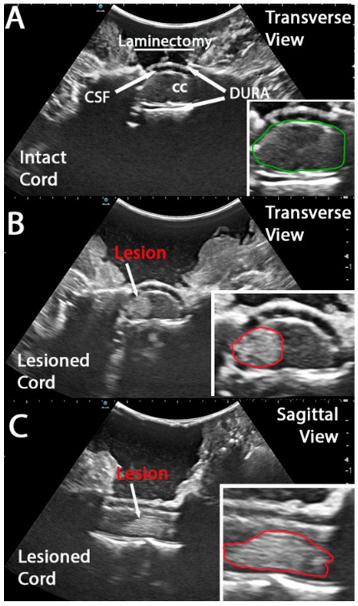 Spinal Cord Injury in Real Time: Intra-Operative Ultrasound for Acute Phase Examination in Non-Human Primates.