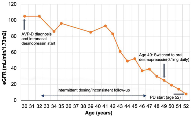 Autosomal Dominant Polycystic Kidney Disease and Idiopathic Arginine Vasopressin Deficiency: A Peculiar Case Report of Accelerated Kidney Function Decline.