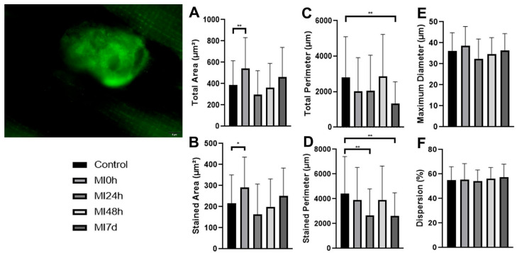 Structural Proteins at Neuromuscular Junction Are Downgraded While NRG1 and Agrin Gene Expression Increases After Muscle Injury.