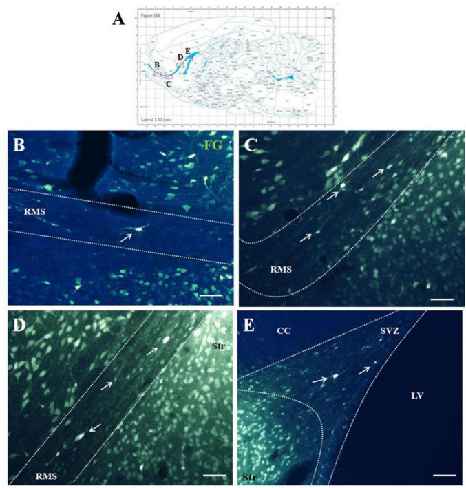 Morphological evidence for neuronal connections between the olfactory neurogenic region and the striatum in adult rats.