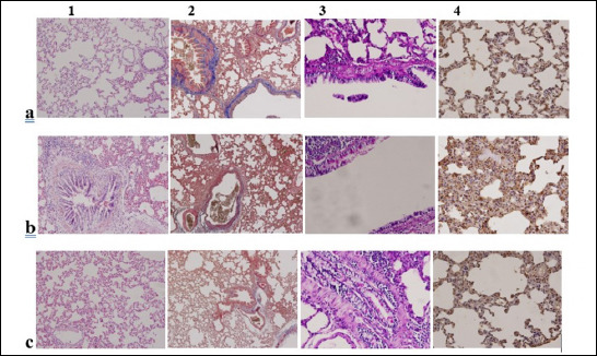 Evaluation of hepatic and remote organ injury in an experimental liver ischemia-reperfusion model in rats and the effects of quercetin on this damage.