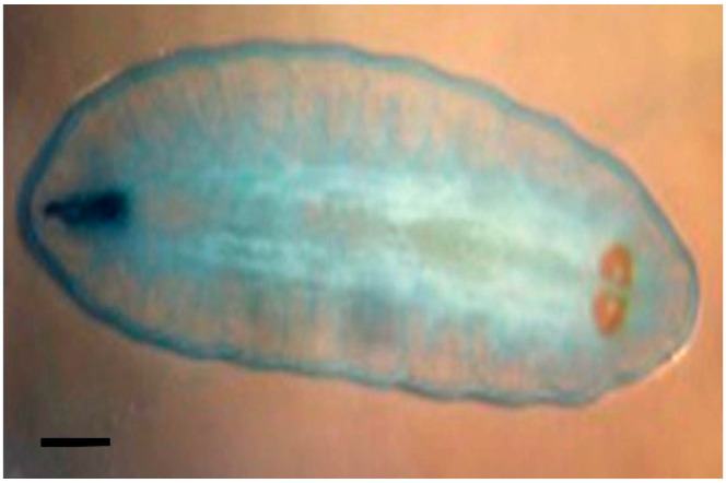 Nasal Myiasis Mimicking Allergic Rhinitis in Immunocompetent Adults: Case Series of 14 Adults.