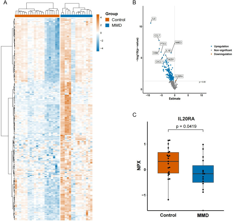 Downregulation of IL-20RA in Cerebrospinal Fluid Associated with the Risk of Moyamoya Disease: A Molecular Signatures Analysis with an Inflammation Proteomics Landscape.