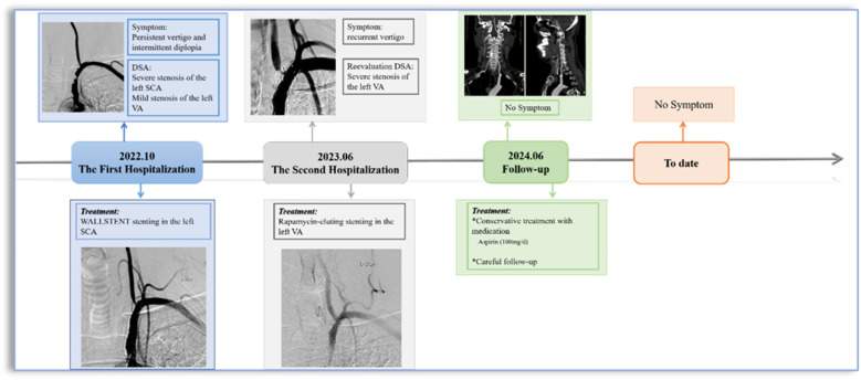 Conservative management of asymptomatic vertebral artery stent fracture with fragment embolisation to V3 segment: a case report.