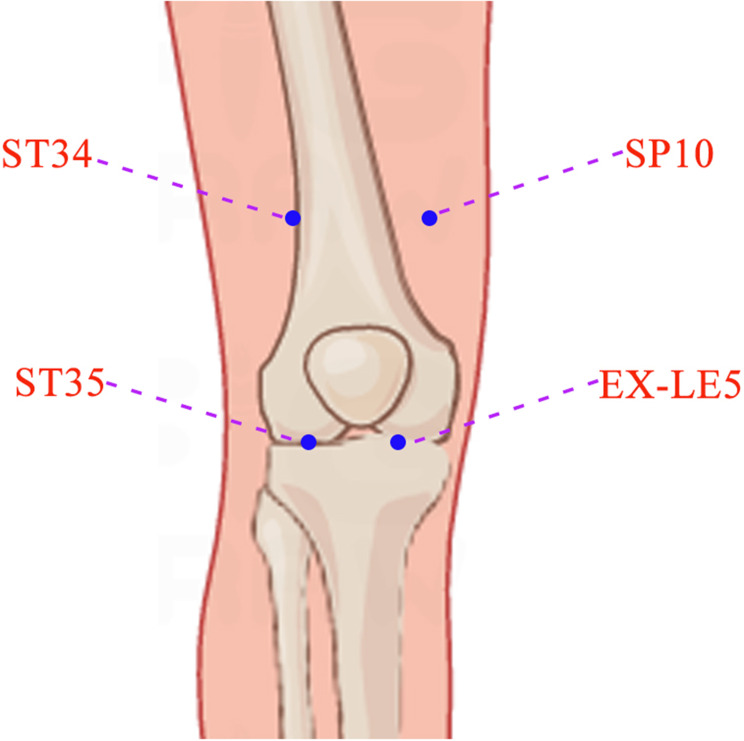Advances in Electroacupuncture for Treatment of Knee Osteoarthritis: Mechanisms, Efficacy, and Future Directions.