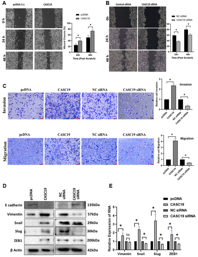 LncRNA CASC19 promotes pancreatic cancer progression by increasing PSPC1 protein stability and facilitating the oncogenic PSPC1/ β-Catenin pathway.