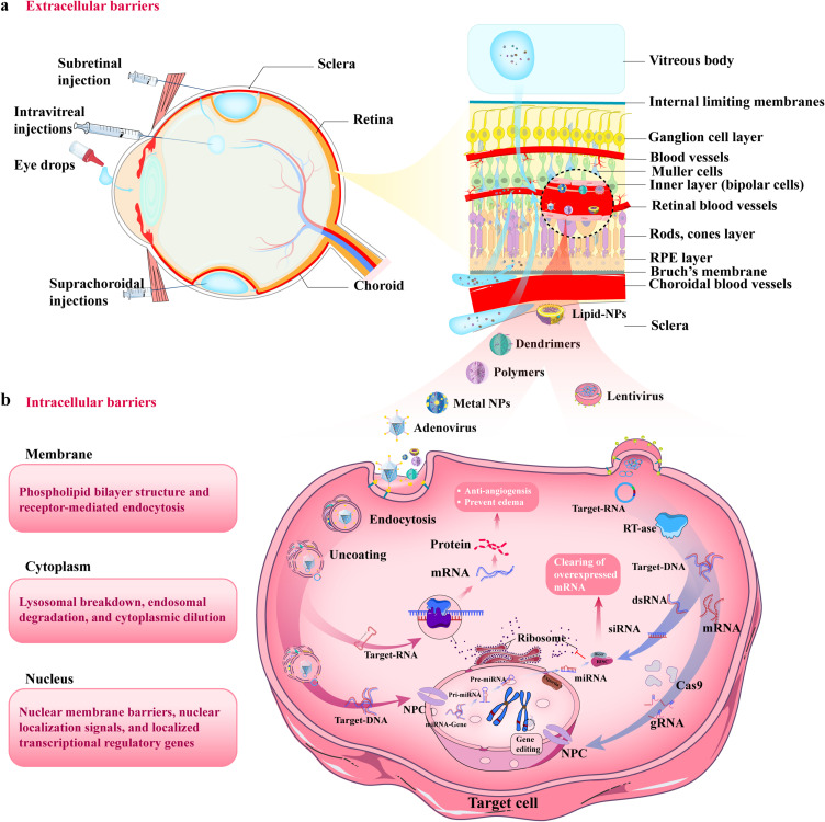 Nanomaterial-Based Anti-Angiogenic Gene Therapy for Retinal Neovascular Diseases: Mechanistic Insights and Preclinical Advances.