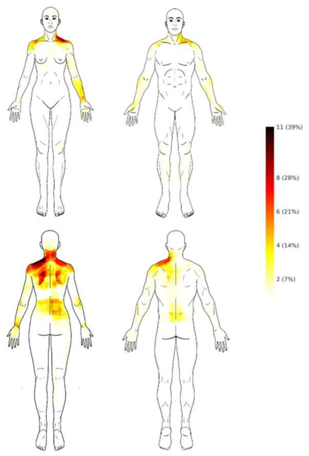 Upper trapezius muscle stiffness among musicians with and without playing-related musculoskeletal disorders: a cross-sectional study.