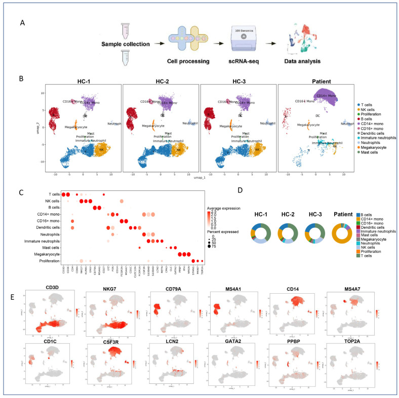 Single-Cell Transcriptomic Analysis Reveals Cell Heterogeneity and Altered Signaling Pathways in Jellyfish Sting Patients.