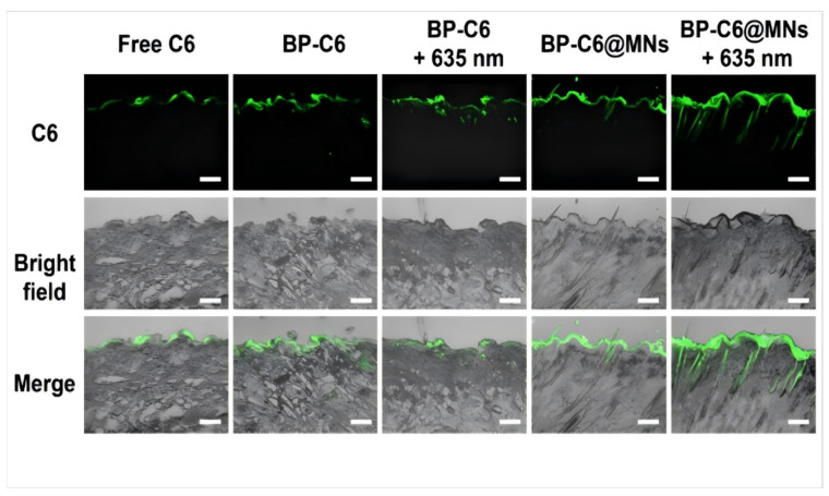 Novel Strategies for Androgenetic Alopecia Therapy: Integrating Multifunctional Plant Extracts with Nanotechnology for Advanced Cutaneous Drug Delivery.