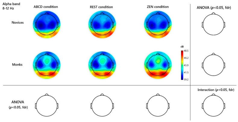 Neural Pattern of Chanting-Driven Intuitive Inquiry Meditation in Expert Chan Practitioners.
