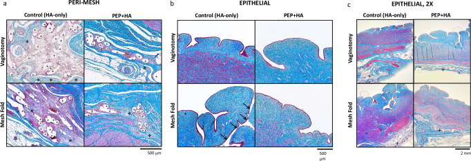 Exosome injection as a prevention strategy for early postoperative mesh complications in a porcine model of sacrocolpopexy.