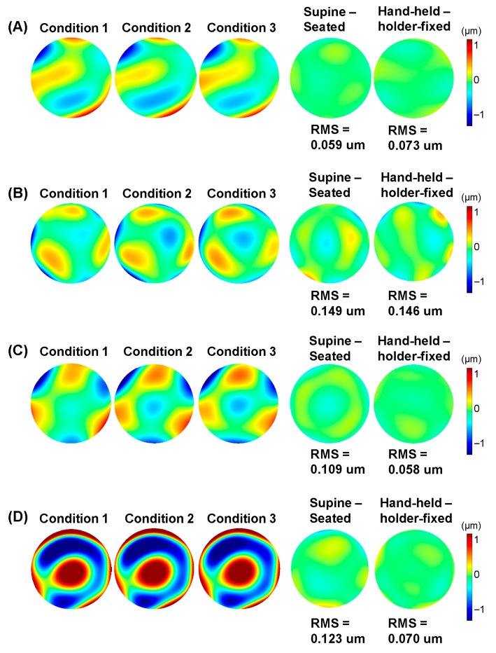 Comparison of Ocular Wavefront in Seated and Supine Positions Using a Hand-Held Hartmann-Shack Aberrometer.