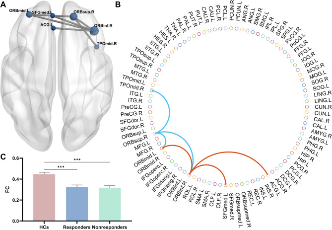 Large-scale neural network correlates of response inhibition associated with antidepressant response in major depressive disorder.