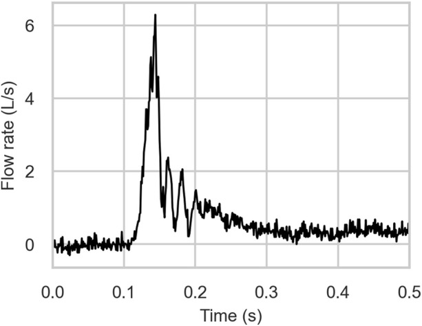 Computational modeling of cough-induced droplets and mucosal film dynamics in the upper airway for pulmonary disease classification.